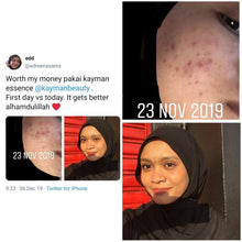 Load image into Gallery viewer, Kayman - Rosa Glow Treatment Essence