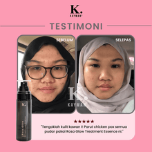 Load image into Gallery viewer, Kayman - Rosa Glow Treatment Essence
