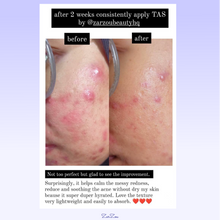 Load image into Gallery viewer, Zarzou - Triple Action Serum (TAS) 30ML