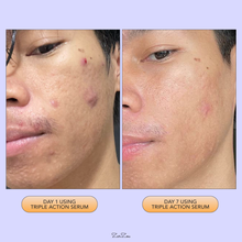 Load image into Gallery viewer, Zarzou - Triple Action Serum (TAS) 30ML