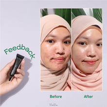 Load image into Gallery viewer, Zarzou - Acne Control Gel (ACG)