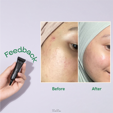 Load image into Gallery viewer, Zarzou - Acne Control Gel (ACG)