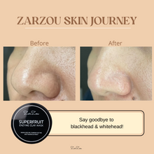 Load image into Gallery viewer, Zarzou - Superfruit Enzyme Clay Mask (SEM)