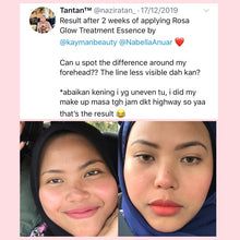 Load image into Gallery viewer, Kayman - Rosa Glow Treatment Essence