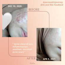Load image into Gallery viewer, Zarzou - Brightening & Hydrating Serum (BHS)