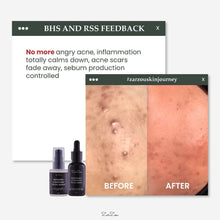 Load image into Gallery viewer, Zarzou - Brightening & Hydrating Serum (BHS)