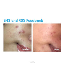 Load image into Gallery viewer, Zarzou - Repairing & Soothing Serum (RSS)