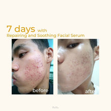 Load image into Gallery viewer, Zarzou - Repairing & Soothing Serum (RSS)