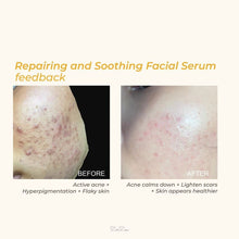 Load image into Gallery viewer, Zarzou - Repairing & Soothing Serum (RSS)