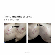 Load image into Gallery viewer, Zarzou - Brightening & Hydrating Serum (BHS)