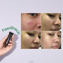 Load image into Gallery viewer, Zarzou - Acne Control Gel (ACG)
