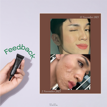 Load image into Gallery viewer, Zarzou - Acne Control Gel (ACG)
