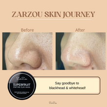 Load image into Gallery viewer, Zarzou - Superfruit Enzyme Clay Mask (SEM)
