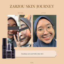 Load image into Gallery viewer, Zarzou - Basic Acne Care
