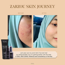 Load image into Gallery viewer, Zarzou - Basic Acne Care
