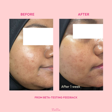 Load image into Gallery viewer, Zarzou - Bloom Serum (Brightening and Hydrating Booster)
