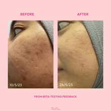 Load image into Gallery viewer, Zarzou - Bloom Serum (Brightening and Hydrating Booster)
