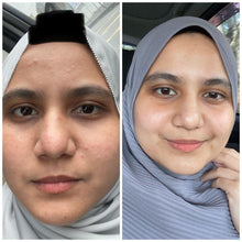 Load image into Gallery viewer, Ferrarossa - Rose Youth Serum
