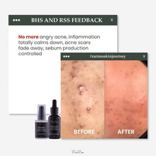 Load image into Gallery viewer, Zarzou - Repairing &amp; Soothing Serum (RSS)
